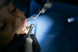 Close-up of dental tools in a clinic, illustrating extraction healing timeline.