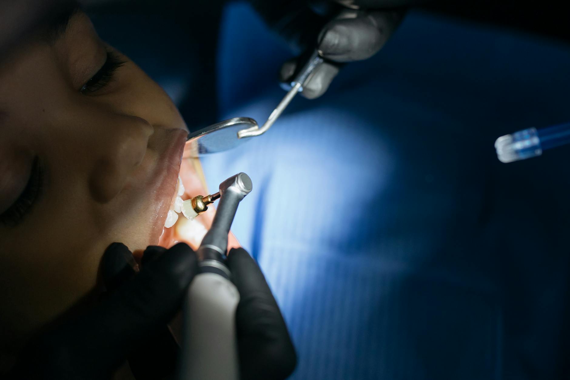 Close-up of dental tools in a clinic, illustrating extraction healing timeline.
