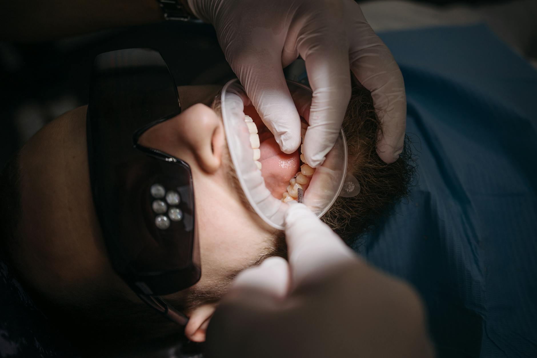 Dentist performing a tooth extraction procedure on a patient.